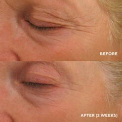 HydroPeptide Eye Authority -Cosmetic Care Store HP PDP EyeAuthority Hero B A 295x d9ea35c1 36f8 4837 942a 5ddab619ebed