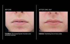 PCA Skin Hydrating Serum 1oz -Cosmetic Care Store Hydratingserumb a 1500x1500 ce46e819 d24d 4181 aca7 7e249d63f9ca