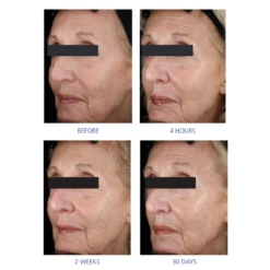 IS Clinical Youth Eye Complex -Cosmetic Care Store OnlineListingImage 5 1024x1024 d80f8de6 6f8b 475b a393 2d2e6ebe8cfe