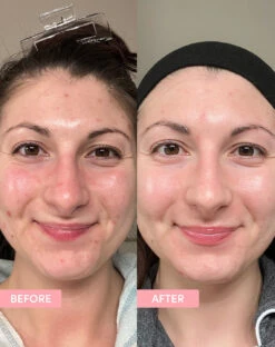 Sand & Sky Marshmallow Toner -Cosmetic Care Store SS PDP MarshmallowToner 4 BA 1140x1440 crop center 6e368b6f 8c85 443a 8440 5f040e20da3d