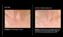 PCA Skin Pigment Bar -Cosmetic Care Store pigmentbarb a 1500x1500 2f858c0e 0bff 4cb3 b5df 9698b1d0203e