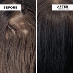 WE ARE PARADOXX Growth Advanced Scalp Serum 50ml 18 WE ARE PARADOXX Growth Advanced Scalp Serum 50ml -Cosmetic Care Store serum2 min