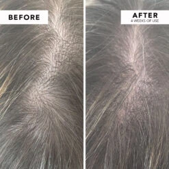 WE ARE PARADOXX Growth Advanced Scalp Serum 50ml 20 WE ARE PARADOXX Growth Advanced Scalp Serum 50ml -Cosmetic Care Store serum4 min