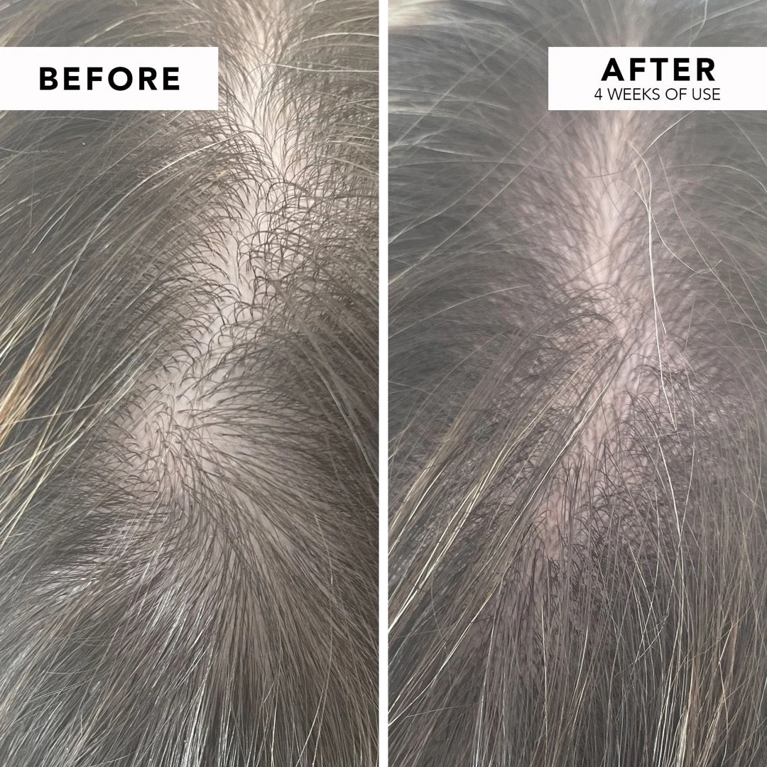 WE ARE PARADOXX Growth Advanced Scalp Serum 50ml 8 WE ARE PARADOXX Growth Advanced Scalp Serum 50ml - Image 6