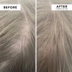 WE ARE PARADOXX Growth Advanced Scalp Serum 50ml 23 WE ARE PARADOXX Growth Advanced Scalp Serum 50ml -Cosmetic Care Store serum7 min