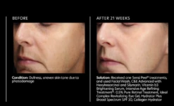 PCA Skin Vitamin B3 Brightening Serum 13 PCA Skin Vitamin B3 Brightening Serum -Cosmetic Care Store vitaminb3benefits2 1500x1500 31d038ec 7c33 4805 93e0 4d0876c152e0