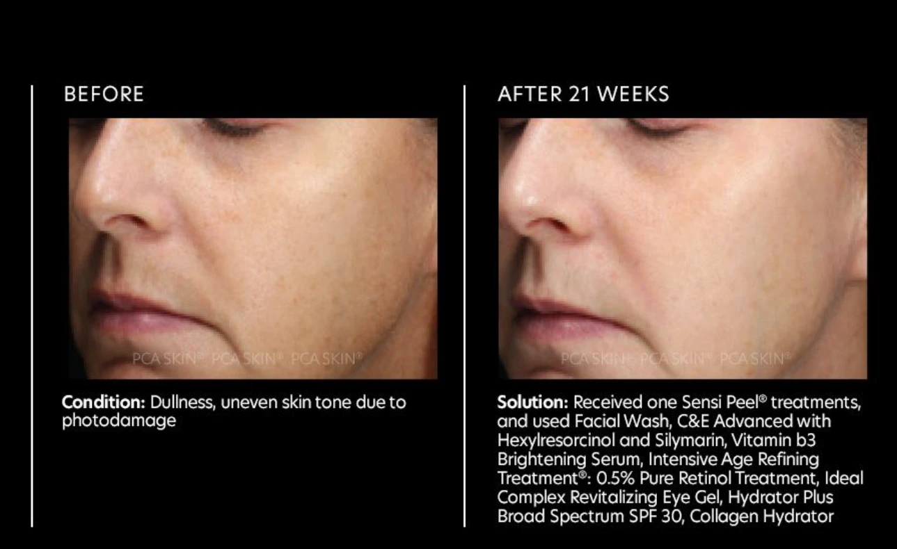 PCA Skin Vitamin B3 Brightening Serum 8 PCA Skin Vitamin B3 Brightening Serum - Image 6